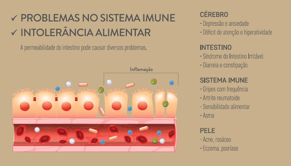 SAÚDE INTESTINAL – A IMPORTÂNCIA DO INTESTINO PARA A NOSSA SAÚDE.